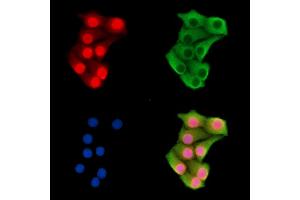 anti-High Mobility Group Nucleosomal Binding Domain 3 (HMGN3) antibody
