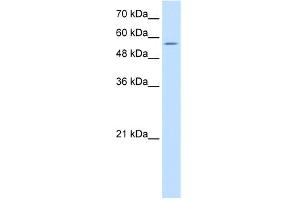 WB Suggested Anti-PDCD4 Antibody   Titration: 10 ug/ml   Positive Control: Jurkat Whole Cell (PDCD4 Antikörper  (N-Term))