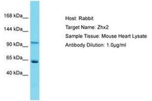 Image no. 1 for anti-Zinc Fingers and Homeoboxes 2 (ZHX2) (AA 703-752) antibody (ABIN6750296) (ZHX2 Antikörper  (AA 703-752))