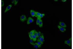 Immunofluorescence staining of HepG2 cells with ABIN7160289 at 1:200, counter-stained with DAPI. (MUC2 Antikörper  (AA 569-657))