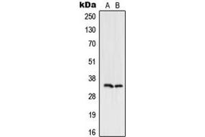 Western blot analysis of UDG expression in HeLa (A), Jurkat (B) whole cell lysates.