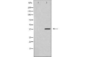Western blot analysis of CXCR4 expression in K562 cells,The lane on the left is treated with the antigen-specific peptide. (CXCR4 Antikörper  (C-Term))
