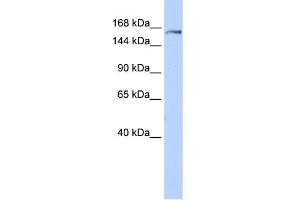 WB Suggested Anti-EPRS Antibody Titration:  0. (EPRS Antikörper  (Middle Region))