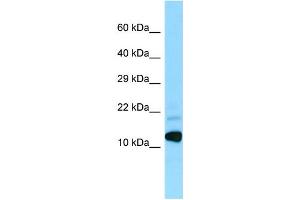 WB Suggested Anti-BRI3 Antibody Titration: 1. (BRI3 Antikörper  (N-Term))