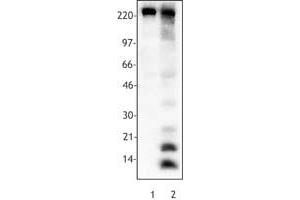 Image no. 1 for anti-Acetylated Lysine antibody (ABIN300042) (Acetylated Lysine Antikörper)
