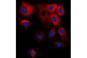 Immunofluorescent analysis of Cytochrome P450 2B6 staining in HepG2 cells. (CYP2B6 Antikörper  (Center))