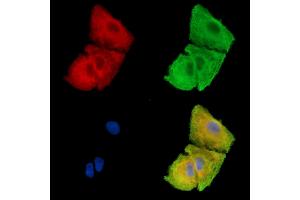 ABIN7096231 and ABIN7100293 staining  cells by IF/ICC. (FAM83H Antikörper)