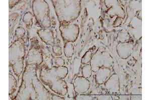 Image no. 1 for anti-Suppressor of Cytokine Signaling 5 (SOCS5) (AA 1-110) antibody (ABIN599092) (SOCS5 Antikörper  (AA 1-110))