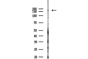 anti-Topoisomerase (DNA) II beta 180kDa (TOP2B) (N-Term) antibody