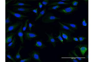 Immunofluorescence of purified MaxPab antibody to AK3L1 on HeLa cell. (AK4 Antikörper  (AA 1-223))
