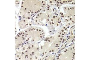 Immunohistochemistry of paraffin-embedded human stomach using RBPJ Antibody. (RBPJ Antikörper)