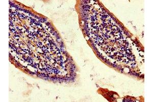 Immunohistochemistry (IHC) image for anti-CDGSH Iron Sulfur Domain 2 (CISD2) (AA 61-135) antibody (ABIN7147222)
