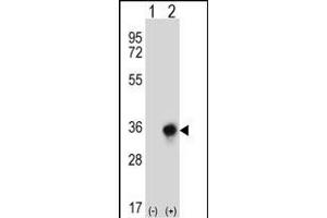 Western blot analysis of CBR3 (arrow) using rabbit polyclonal CBR3 Antibody (C-term) (ABIN656808 and ABIN2846022). (CBR3 Antikörper  (C-Term))