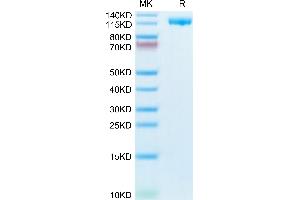 CD21 Protein (AA 21-971) (His tag)