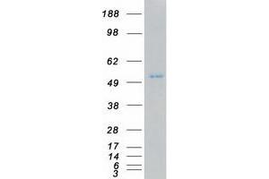 Validation with Western Blot (ZAK Protein (Transcript Variant 2) (Myc-DYKDDDDK Tag))