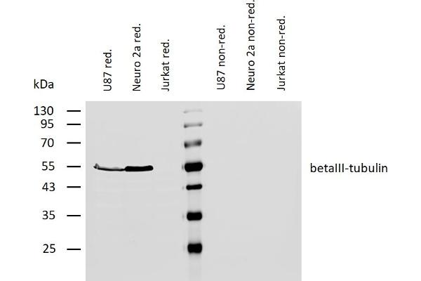 TUBB3 Antikörper  (N-Term)
