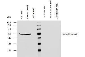 Western blotting analysis of human betaIII-tubulin using mouse monoclonal antibody TU-20 on lysates of U87 cells and Neuro 2a cells (and Jurkat cells as a negative control) under reducing and non-reducing conditions. (TUBB3 Antikörper  (N-Term))