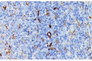 Immunohistochemistry of paraffin-embedded Rat spleen using MMP25 Polyclonal Antibody at dilution of 1:100 (40x lens). (MMP25 Antikörper)