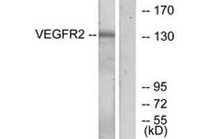 Western blot analysis of extracts from K562 cells, treated with LPS 100ng/ml 30', using VEGFR2 (Ab-1175) Antibody. (VEGFR2/CD309 Antikörper  (AA 1141-1190))