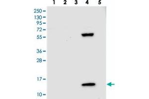 Western blot analysis of Lane 1: RT-4, Lane 2: U-251 MG, Lane 3: Human Plasma, Lane 4: Liver, Lane 5: Tonsil with PPP4R4 polyclonal antibody  at 1:250-1:500 dilution. (PPP4R4 Antikörper)