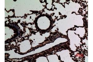 Immunohistochemistry (IHC) image for anti-Signal Transducer and Activator of Transcription 2, 113kDa (STAT2) (Tyr1221), (Tyr1222) antibody (ABIN6284459)