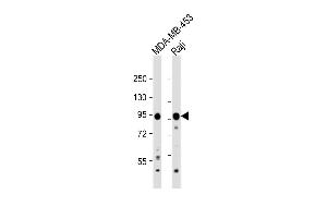 All lanes : Anti-AXIN1 Antibody (C-term) at 1:1000 dilution Lane 1: MDA-MB-453 whole cell lysate Lane 2: Raji whole cell lysate Lysates/proteins at 20 μg per lane. (Axin Antikörper  (C-Term))