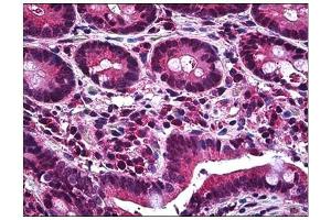 Human Small Intestine: Formalin-Fixed, Paraffin-Embedded (FFPE) (MCL-1 Antikörper  (AA 121-139))