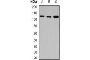 Western blot analysis of HIP1 expression in A549 (A), SW480 (B), mouse brain (C) whole cell lysates. (HIP1 Antikörper)