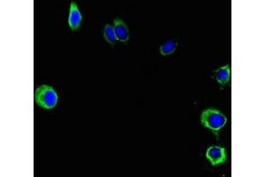 Immunofluorescent analysis of Hela cells using ABIN7162692 at dilution of 1:100 and Alexa Fluor 488-congugated AffiniPure Goat Anti-Rabbit IgG(H+L) (PNPLA2 Antikörper  (AA 1-504))