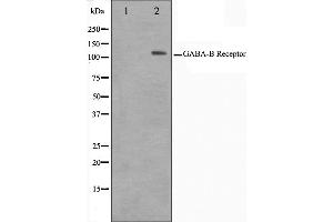 Western blot analysis on HeLa cell lysate using GABBR1 Antibody,The lane on the left is treated with the antigen-specific peptide. (GABBR1 Antikörper  (C-Term))