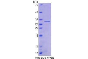 SDS-PAGE analysis of Human AGA Protein. (AGA Protein)