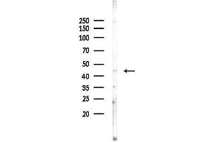 anti-Choline Kinase beta (CHKB) (C-Term) antibody