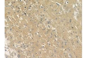 ABIN6262980 and ABIN6272946 at 1/100 staining human normal liver tissue by IHC-P. (PPFIA1 Antikörper  (C-Term))