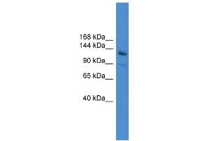 WB Suggested Anti-LARP1  Antibody Titration: 0. (LARP1 Antikörper  (N-Term))