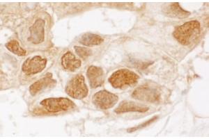 anti-TP53 induced glycolysis regulatory phosphatase (TIGAR) (AA 220-270) antibody