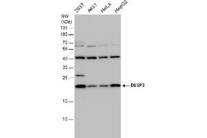 WB Image DUSP3 antibody detects DUSP3 protein by western blot analysis. (Dual Specificity Phosphatase 3 (DUSP3) Antikörper)