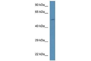 Western Blotting (WB) image for anti-Phosphatidylinositol 4-Kinase Type 2 beta (PI4K2B) (N-Term) antibody (ABIN928941)