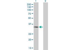 Western Blot analysis of UCP2 expression in transfected 293T cell line by UCP2 MaxPab polyclonal antibody. (UCP2 Antikörper  (AA 1-309))