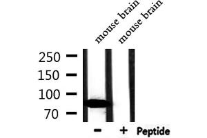 Western blot analysis of extracts from mouse brain, using CFB Antibody. (Complement Factor B Antikörper  (Internal Region))