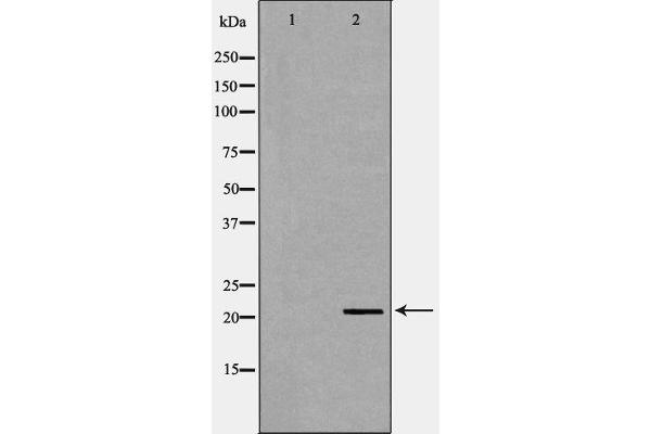 TDGF1 antibody  (Internal Region)