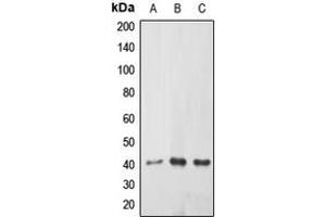 Western blot analysis of ABHD9 expression in HEK239T (A), mouse kidney (B), rat kidney (C) whole cell lysates. (ABHD9 Antikörper  (Center))