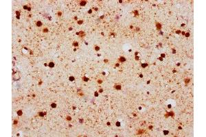 IHC image of ABIN7127309 diluted at 1:100 and staining in paraffin-embedded human brain tissue performed on a Leica BondTM system. (Rekombinanter H2AFX Antikörper  (pSer139))