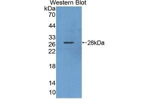 Detection of Recombinant KPNa3, Human using Polyclonal Antibody to Karyopherin Alpha 3 (KPNa3) (KPNA3 Antikörper  (AA 3-220))