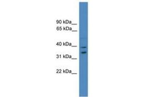 Image no. 1 for anti-Ubiquitin Fusion Degradation Protein 1 Homolog (UFD1L) (AA 161-210) antibody (ABIN6745307) (UFD1L Antikörper  (AA 161-210))
