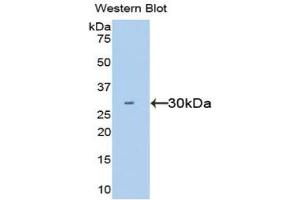 Western blot analysis of the recombinant protein. (HGF Antikörper  (AA 495-728))