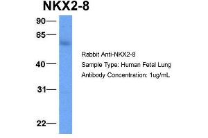 Host:  Rabbit  Target Name:  NKX2-8  Sample Type:  Human Fetal Lung  Antibody Dilution:  1. (NKX2-8 Antikörper  (C-Term))