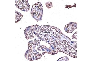 Immunohistochemistry of paraffin-embedded human placenta using PD-L1/CD274 Rabbit pAb (ABIN6129976, ABIN6138153, ABIN6138154 and ABIN6215142) at dilution of 1:100 (40x lens). (PD-L1 Antikörper  (AA 19-238))