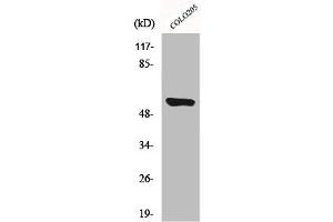 Western Blot analysis of HeLa cells using CYP4A11/22 Polyclonal Antibody
