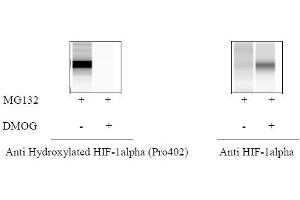 HeLa cells were treated or untreated with MG132 and DMOG. (Hydroxylated HIF-1 alpha (P402) ELISA Kit)