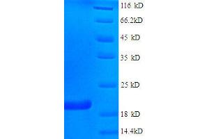 SDS-PAGE (SDS) image for Fragile Histidine Triad (FHIT) (AA 2-147), (full length) protein (His tag) (ABIN1046624)
